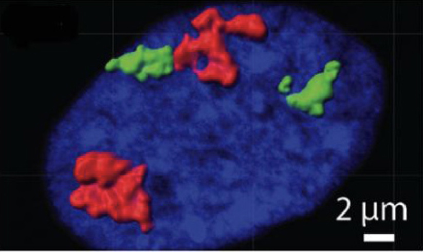 The nucleus of a nonsenescent cell shows chromosomes 4 (red) and 18 (green), which appear significantly larger than in the nucleus of a senescent (aging) cell.