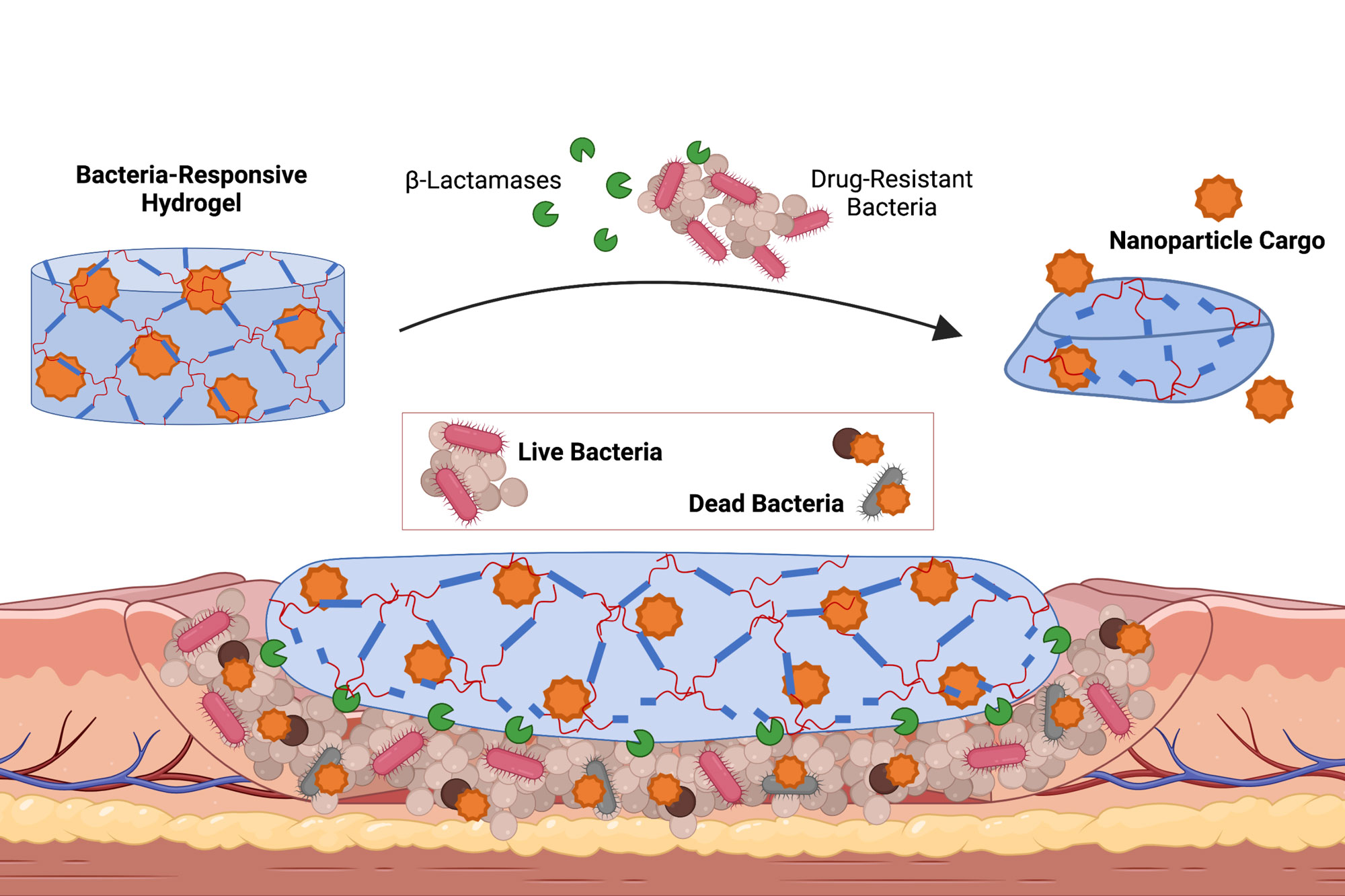 For the new material, Shukla and her team developed a hydrogel that is sensitive to beta-lactamases, a class of enzymes released by a variety of harmful bacteria. The presence of beta-lactamases causes the material’s crosslinked polymer network to degrade, releasing the encapsulated therapeutic nanoparticles.